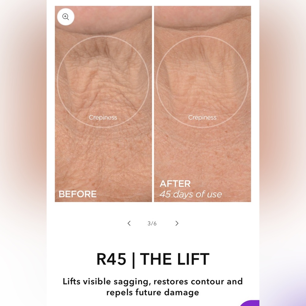 BeautyBio R45 the Lift phase 3 & 4 - Picture 4 of 10